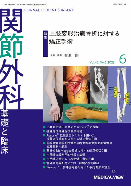 関節外科 2023年6月号 (発売日2023年05月19日) 表紙