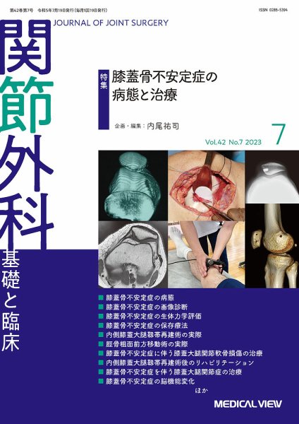 関節外科 2023年7月号 (発売日2023年06月21日) 表紙