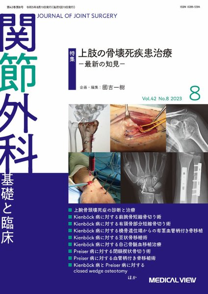 関節外科 2023年8月号 (発売日2023年07月21日) 表紙