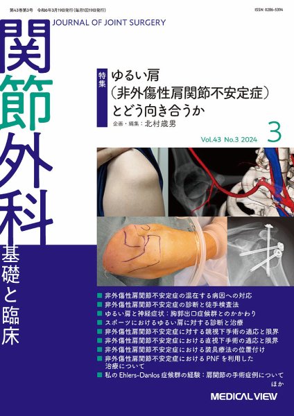 関節外科 2024年3月号 (発売日2024年02月20日) 表紙
