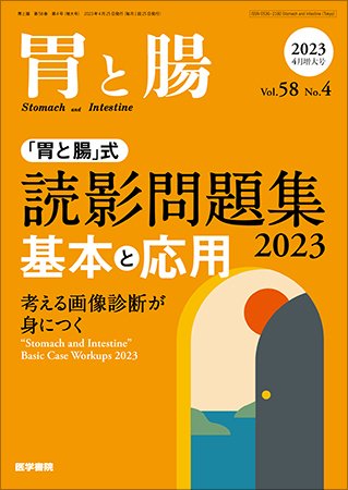 胃と腸 Vol.58 No.4 (発売日2023年04月25日) 表紙