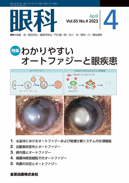眼科 2023年4月号 (発売日2023年04月20日) 表紙