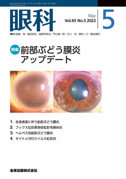 眼科 2023年5月号 (発売日2023年05月20日) 表紙