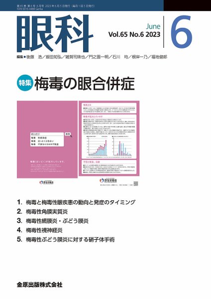 眼科 2023年6月号 (発売日2023年06月20日) 表紙