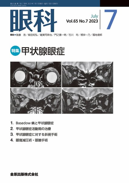 眼科 2023年7月号 (発売日2023年07月20日) 表紙