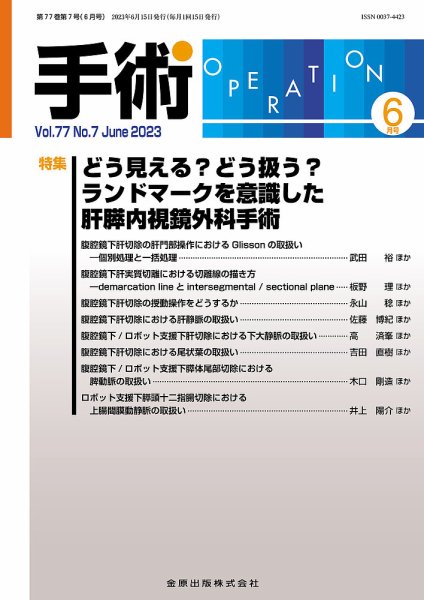 手術 2023年6月号 (発売日2023年06月05日) 表紙