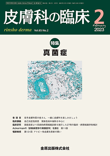 皮膚科の臨床 2023年2月号 (発売日2023年02月20日) | 雑誌/定期購読の