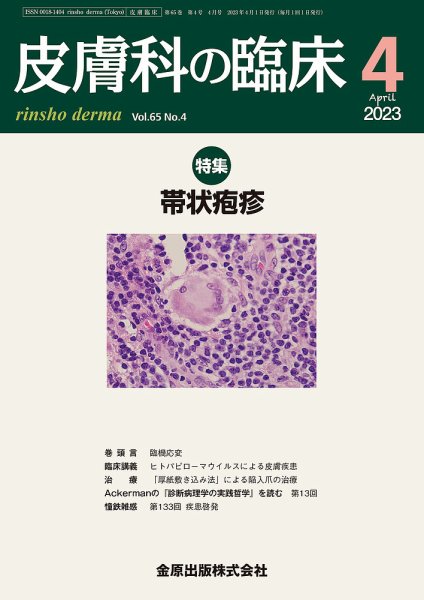 皮膚科の臨床 2023年4月号 (発売日2023年04月20日) 表紙