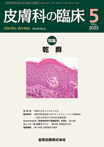 皮膚科の臨床 2023年5月号 (発売日2023年05月20日) | 雑誌/定期