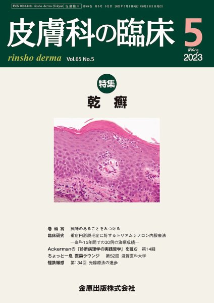 皮膚科の臨床 2023年5月号 (発売日2023年05月20日) 表紙