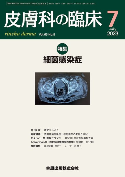 皮膚科の臨床 2023年7月号 (発売日2023年07月20日) 表紙