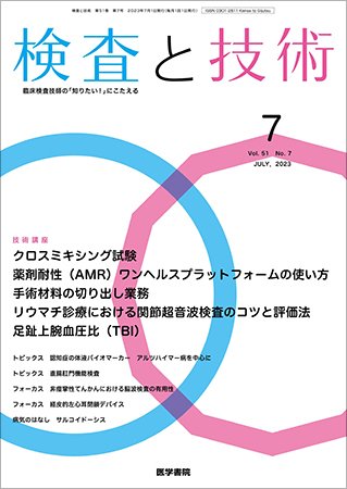 検査と技術 Vol.51 No.7 (発売日2023年07月01日) 表紙