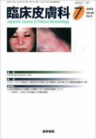 臨床皮膚科 63巻8号 表紙