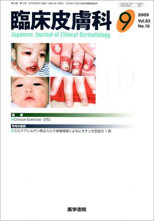 臨床皮膚科 63巻10号 (発売日2009年09月01日) 表紙