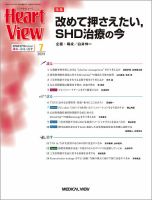 アート shd 販売 株価