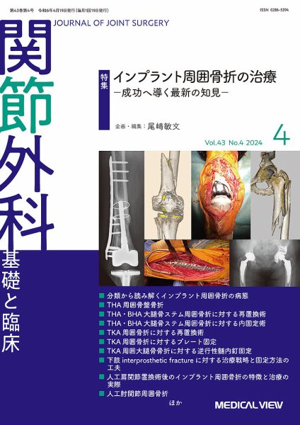 関節外科 2024年4月号 (発売日2024年03月22日) 表紙