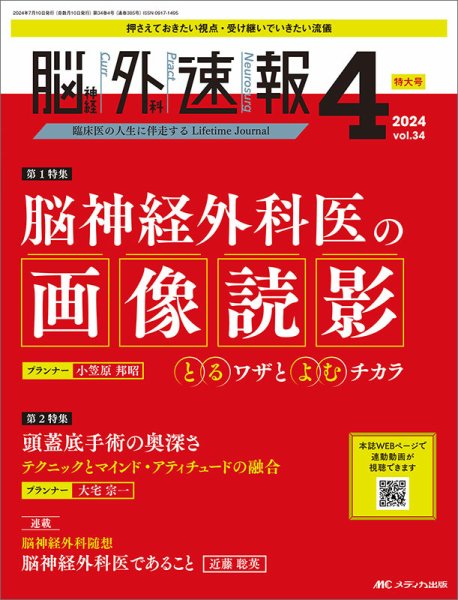 脳神経外科速報 2024年4号 (発売日2024年06月29日) 表紙