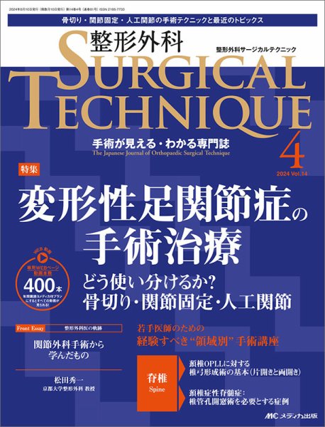整形外科サージカルテクニック 2024年4号 (発売日2024年07月15日) 表紙
