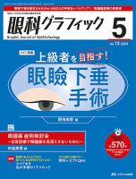 眼科グラフィック2024増刊　網膜硝子体手術　裁断済み 網膜硝子体手術：基本と応用，トラブル＆リカバリーがわかる