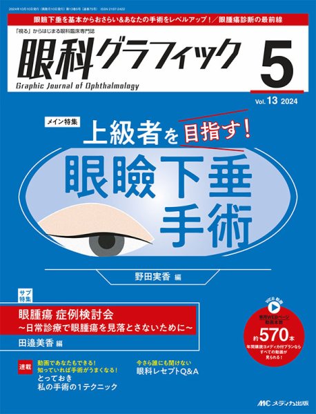 眼科グラフィック 2024年5号	 (発売日2024年09月15日) 表紙