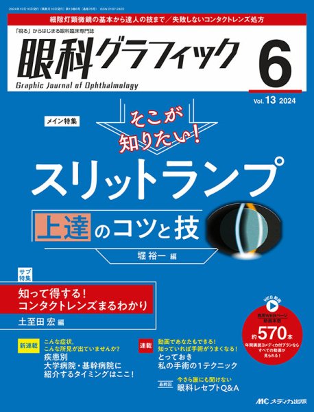 眼科グラフィック 2024年6号	 (発売日2024年11月15日) 表紙