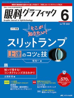 眼科グラフィック 2024年6号	 (発売日2024年11月15日) 表紙