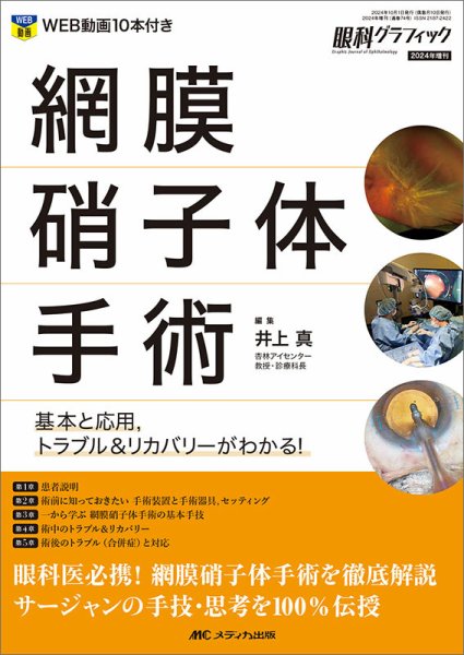 眼科グラフィック 2024年増刊号 (発売日2024年09月25日) 表紙