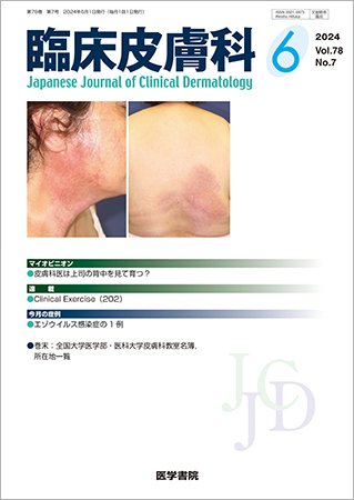 臨床皮膚科 Vol.78 No.7 (発売日2024年06月25日) 表紙