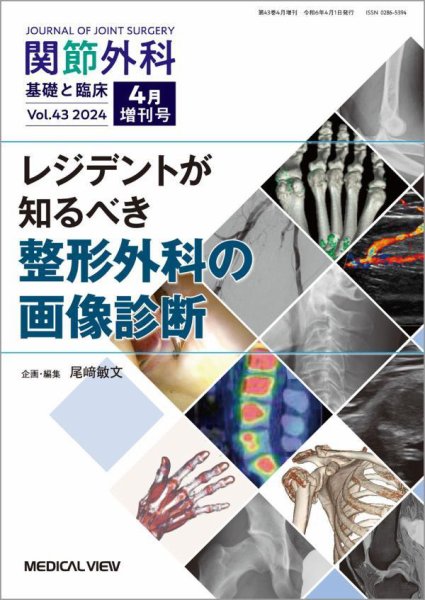 関節外科 4月増刊号 (発売日2024年04月03日) 表紙