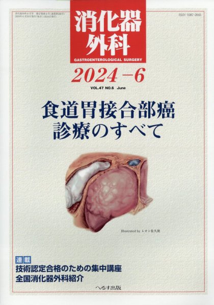 消化器外科 2024年6月号 (発売日2024年06月12日) 表紙