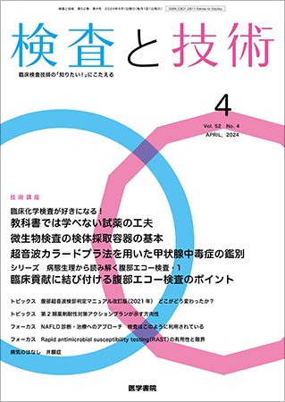 検査と技術 Vol.52 No.4 (発売日2024年04月01日) 表紙