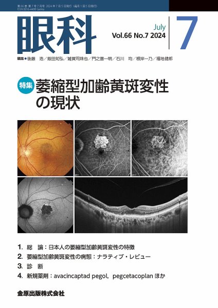眼科 2024年7月号 (発売日2024年07月20日) 表紙