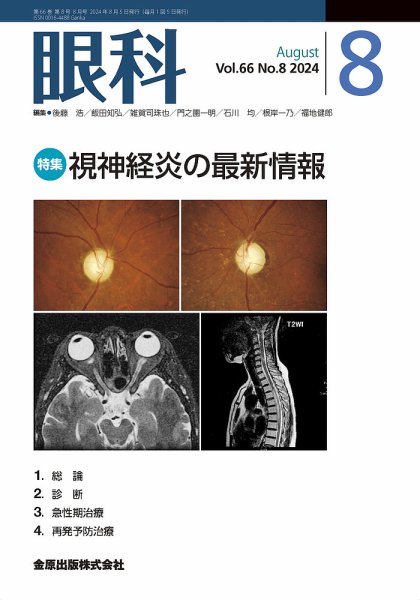 眼科 2024年8月号 (発売日2024年08月20日) 表紙
