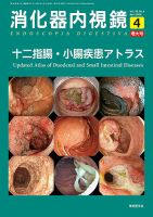 消化器内視鏡の最新号【24年4月増大号 (発売日2024年04月25日)】| 雑誌 