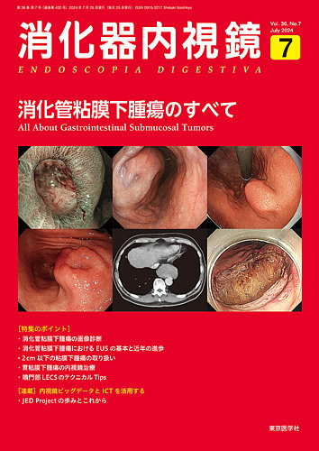 消化器内視鏡第24巻5号増大号 なんじゃこりゃ?-内視鏡像は語る! (消化器内視鏡2012年5月増大号) 消化器内視鏡 24年4月増大号 (発売日2024年04月25日) | 雑誌