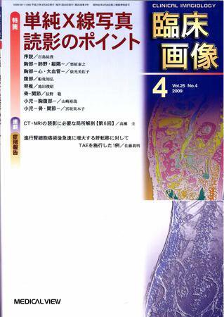 臨床画像 2009年4月号 (発売日2009年03月26日) 表紙