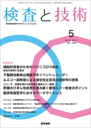 検査と技術 Vol.52 No.5 (発売日2024年05月01日) 表紙