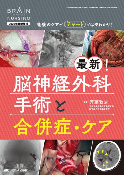 BRAIN NURSING（ブレインナーシング） 夏季増刊 (発売日2025年07月31日) 表紙