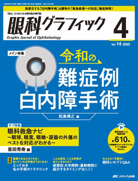 眼科グラフィック 2025年4号 (発売日2025年07月15日) 表紙