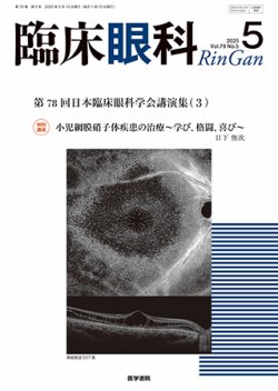 臨床眼科 Vol.79 No.5 (発売日2025年05月15日) 表紙