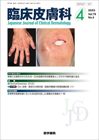 臨床皮膚科 Vol.79 No.4 (発売日2025年04月25日) 表紙