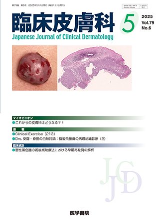 臨床皮膚科 Vol.79 No.6 (発売日2025年05月25日) 表紙