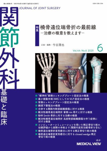 関節外科 2025年6月号 (発売日2025年05月21日) | 雑誌/定期購読の予約
