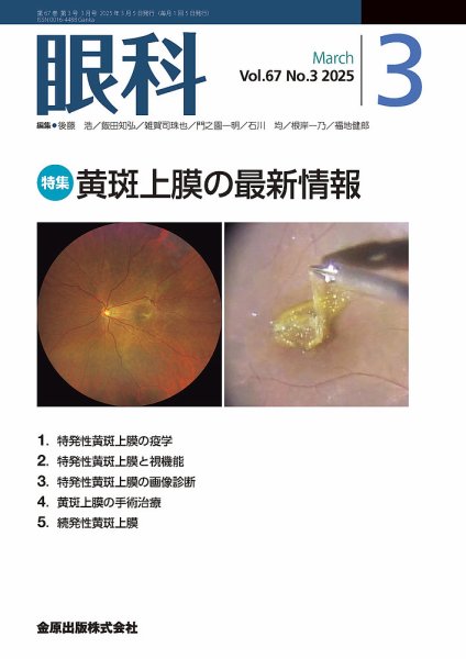 眼科 2025年3月号 (発売日2025年03月20日) 表紙