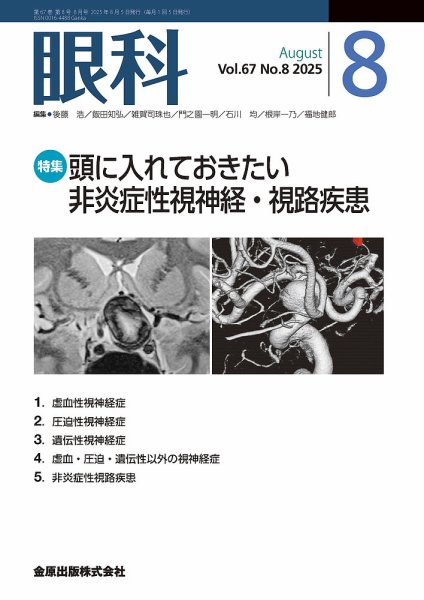 眼科 2025年8月号 (発売日2025年08月20日) 表紙