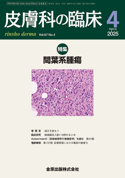 皮膚科の臨床 2025年4月号 (発売日2025年04月20日) 表紙