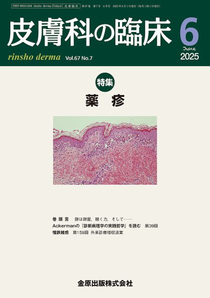 皮膚科の臨床 2025年6月号 (発売日2025年06月20日) 表紙