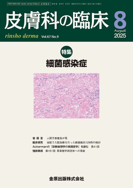 皮膚科の臨床 2025年8月号 (発売日2025年08月20日) 表紙