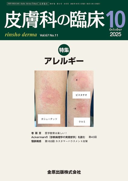 皮膚科の臨床 2025年10月号 (発売日2025年10月20日) 表紙