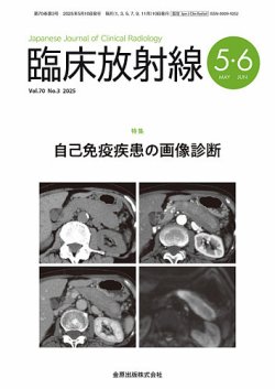 臨床放射線 2025年5月号 (発売日2025年05月20日) 表紙